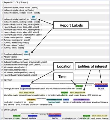Understanding the performance and reliability of NLP tools: a comparison of four NLP tools predicting stroke phenotypes in radiology reports